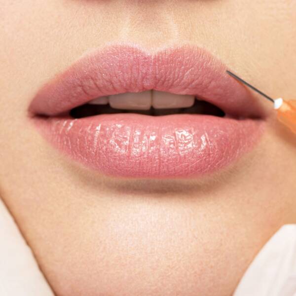 Foundation Dermal Filler Training