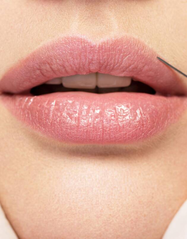 Foundation Dermal Filler Training