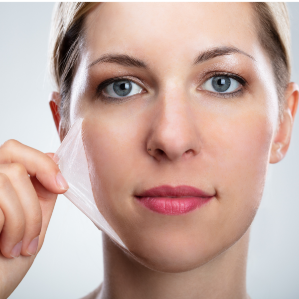 Chemical Peel Training