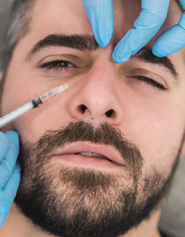 Advanced Dermal Filler Training (Non-surgical Rhinoplasty)